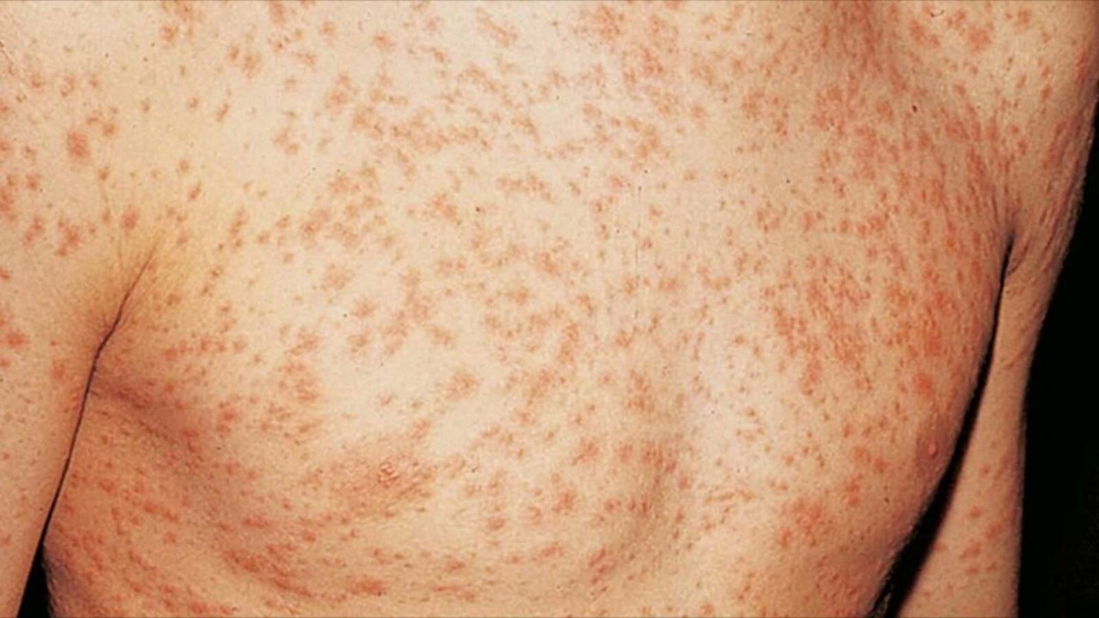 Зафиксирована критическая ситуация